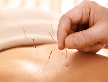 中医针灸法的特点