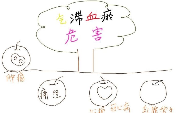 中医学中的气滞血瘀