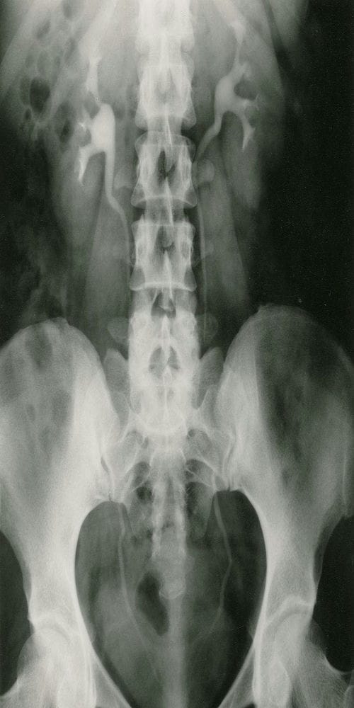 医学影像学泌尿系统复习重点