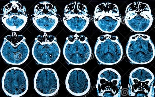 MRI常用术语（上）